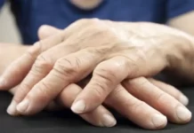 woman s hands displaying rheumatoid arthritis 1068x601 1