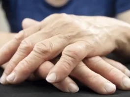 woman s hands displaying rheumatoid arthritis 1068x601 1