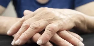 woman s hands displaying rheumatoid arthritis 1068x601 1
