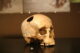 1280px Crane trepanation img 0507