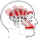 temporalis trigger points e1606637602422