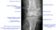 bone lesion differential diagnosis illustrationsab