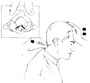 Atlantoaxial Instability Causes And Symptoms Explained OsteoMag Atlantoaxial Instability Causes And Symptoms Explained OsteoMag