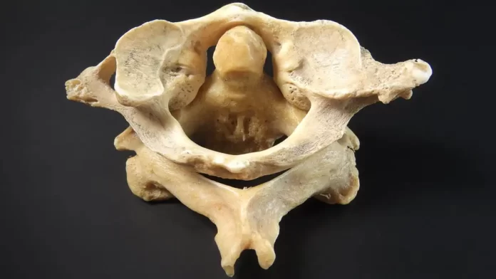 Vertebra   atlas axis superior
