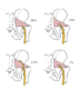 piriformis-1