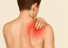 Nerf suprascapulaire : symptômes, diagnostic et réadaptation