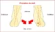 Schema-Pronation-du-pied