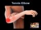 Miniature de la vidéo : Tennis Elbow,  why it hurts?  Everything You Need To Know – Dr. Nabil Ebraheim