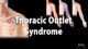 Miniature de la vidéo : Thoracic Outlet Syndrome (TOS), Animation