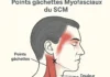 Étourdissements cervicogéniques : quel rôle réel pour le SCM et l’ostéopathie ?