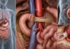 Ligament de Treitz : anatomie, syndrome de l’artère mésentérique supérieure et limites de l’ostéopathie Ligament de Treitz : anatomie, syndrome de l’artère mésentérique supérieure et limites de l’ostéopathie