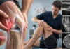 Syndrome de plica médiopatellaire : douleur, clic et accrochage à l’avant du genou