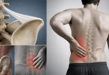 Syndrome iliolombaire : une cause méconnue de douleur lombaire près de la crête iliaque Syndrome iliolombaire : une cause méconnue de douleur lombaire près de la crête iliaque