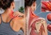 Muscle dur : distinguer tension, raideur et force