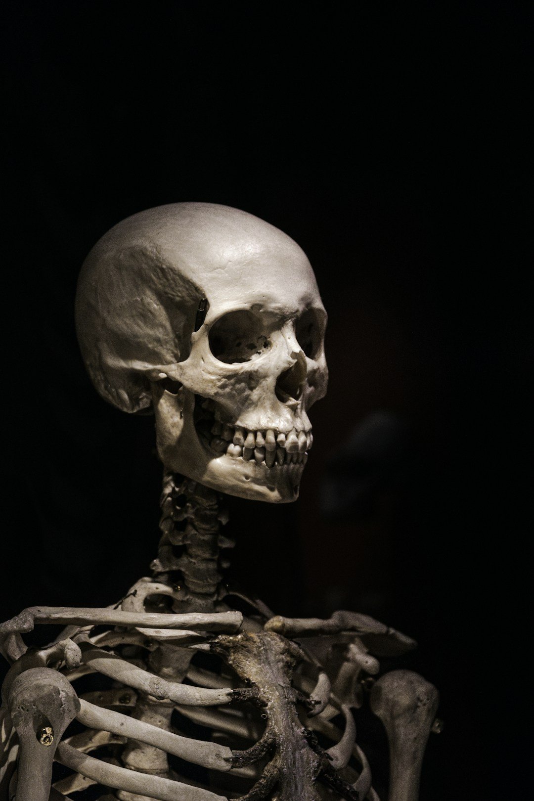Photographie d’un squelette montrant le crâne, la colonne cervicale et la ceinture scapulaire.