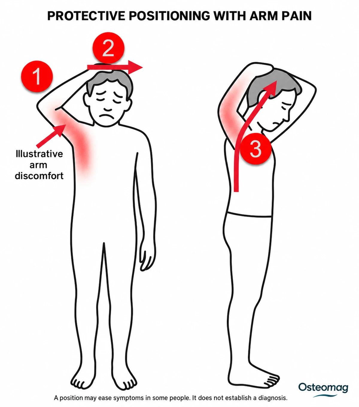 Person placing a hand on the head while experiencing arm discomfort