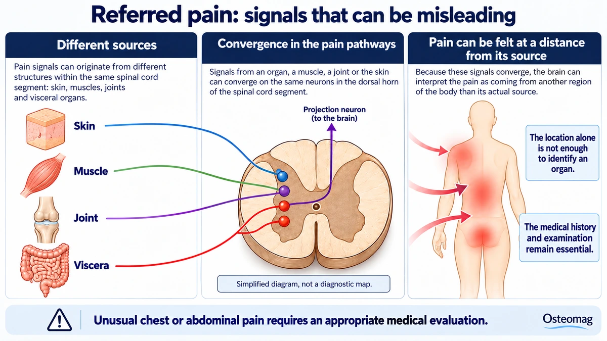 Simplified illustration of somatic and visceral signal convergence in pain pathways