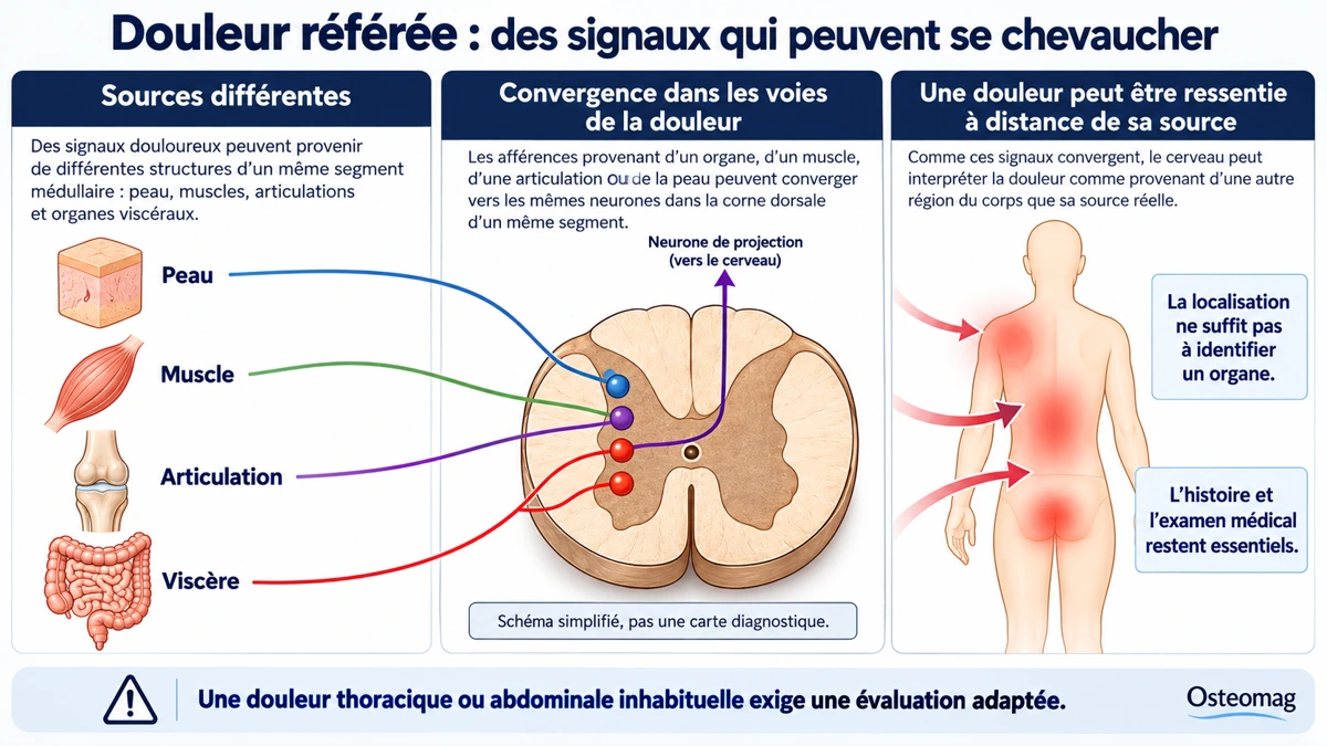 Illustration simplifiée de la convergence des signaux somatiques et viscéraux dans les voies de la douleur